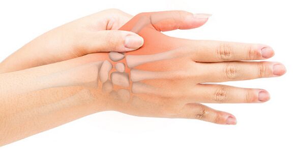 Zwężające się zapalenie więzadeł blokuje palec w pozycji zgiętej